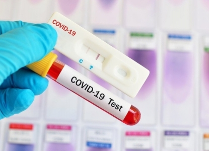  გასული დღე-ღამის განმავლობაში გარდაიცვალა COVID-19-ით დაავადებული 44 პაციენტი